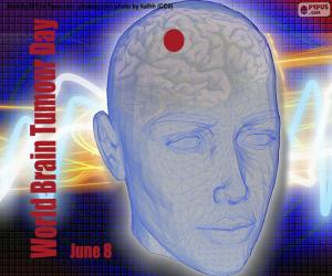 Puzzle Journée internationale des tumeurs cérébrales